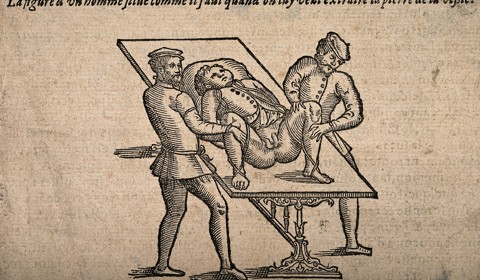 Een patiënt op een tafel wordt door twee assistenten vastgehouden